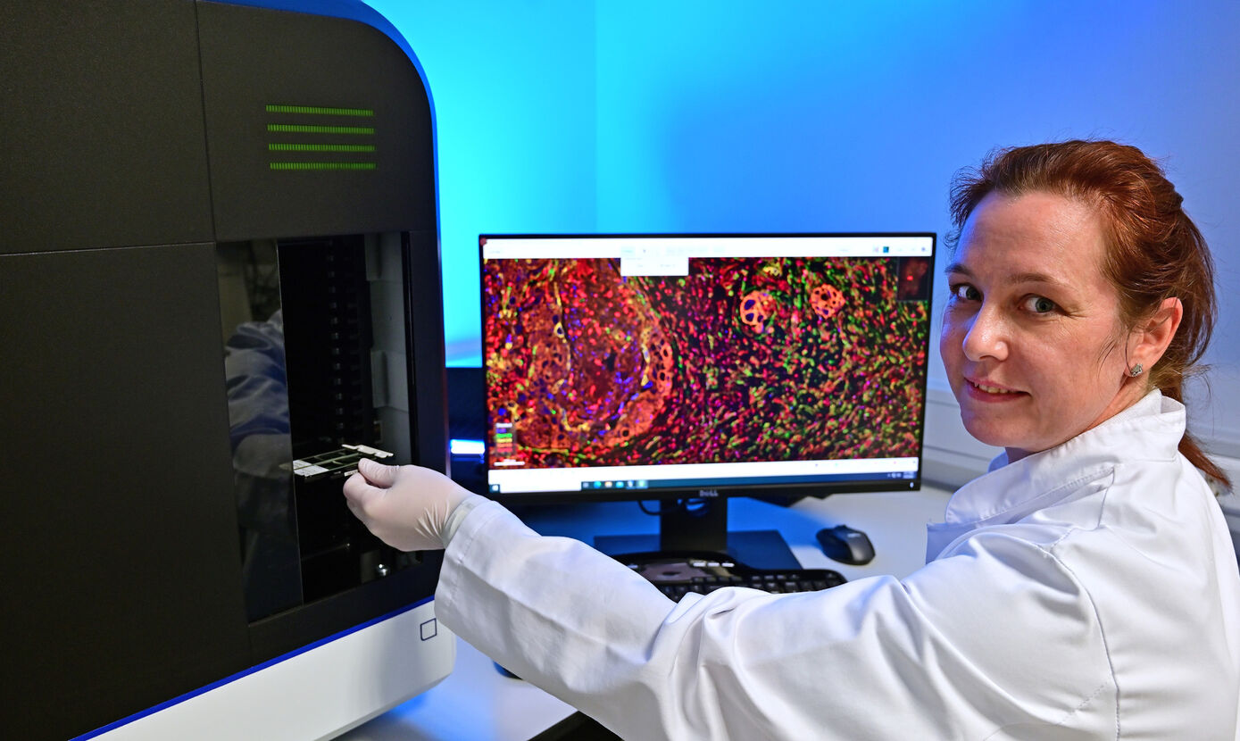 Das Forschungsteam der Pathologie am UKJ, hier Labormitarbeiterin Dagmar Samsel, nutzt einen Multispektral-Fluoreszenz-Scanner, um die Mechanismen der Tumorentstehung in Gewebepräparaten zu untersuchen.
Foto: Michael Szabó/UKJ