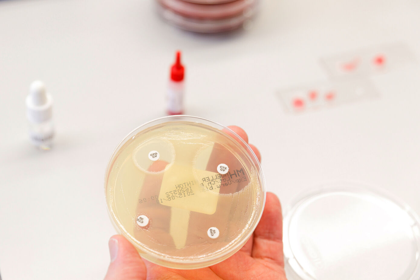 Mikrobiologischer Test auf Antibiotikaresistenzen: Neue S3-Leitlinie für die Behandlung von Infektionen mit multiresistenten Erregern. Fotos: Anna Schroll/UKJ
