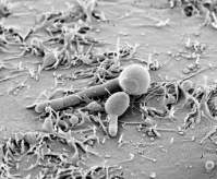 Auskeimende Candida Hyphe während der Interaktion mit einer Epithelzelle