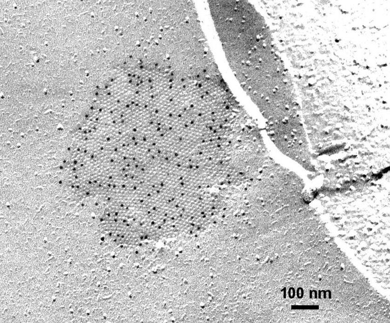 Gap Junction Komplex in der Plasmamembran einer Knochenmark-Stroma Zelle. Immunogold-Markierung des Proteins Connexin 43.