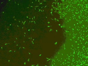 Evaluierung von Biomaterialien: Zellkultur-Test (Fluoreszenz-Mikroskopie): lebend-Färbung