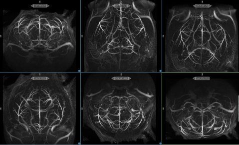 Hochaufgelöste (83µm isotrop), T2-gewichtete anatomische Darstellung eines fixierten Maushirns. Aus dem 3D Datensatz lassen sich nachträglich beliebig orientierte Schichten ohne Bildqualitätsverlust anzeigen.
(Bildrechte: Dr. K.-H. Herrmann)