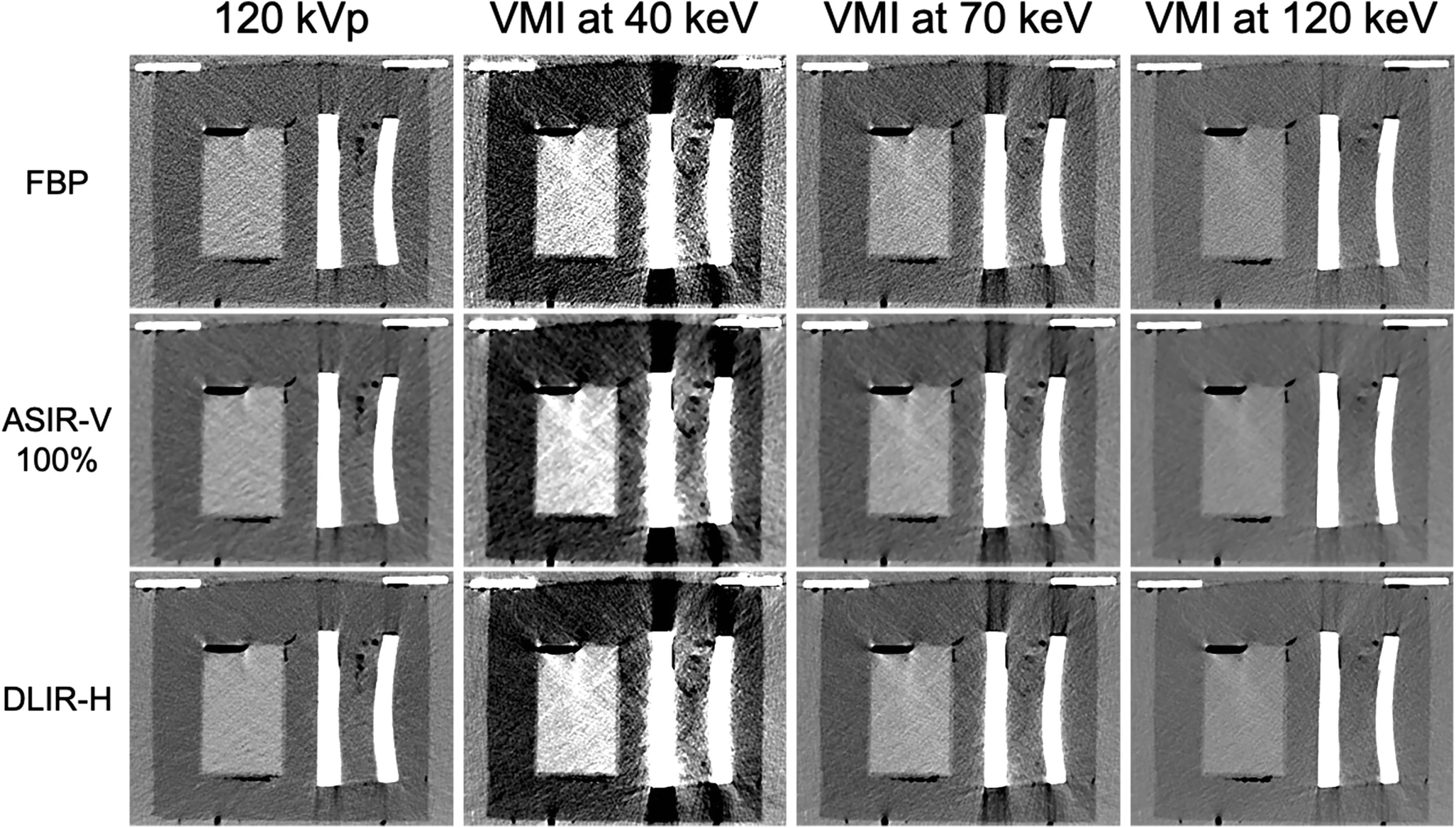 Heinrich, A. et al. CT-based thermometry with virtual monoenergetic images by dual-energy of fat, muscle and bone using FBP, iterative and deep learning–based reconstruction. Eur Radiol 32, 424–431 (2022).