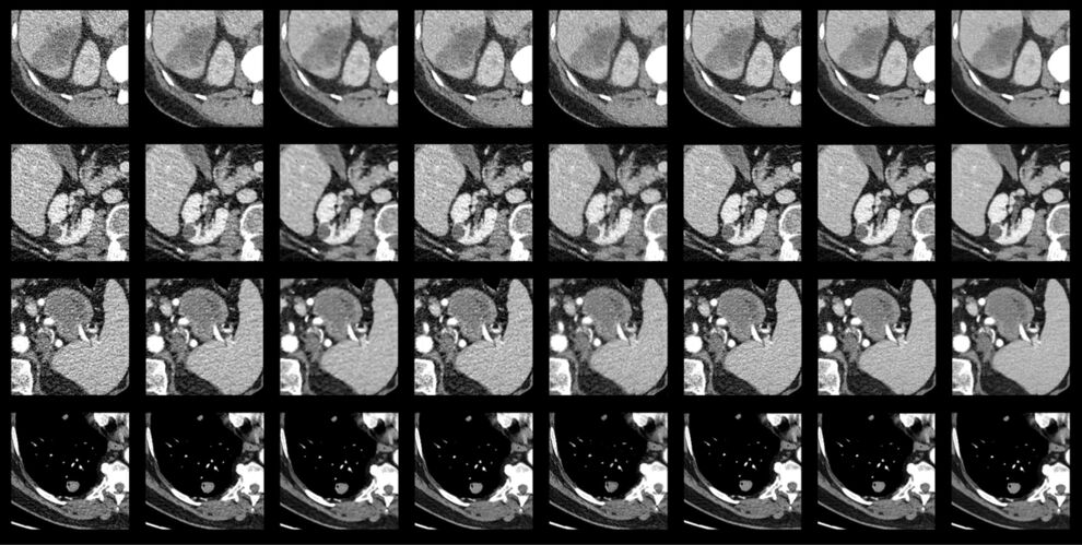 Bertl, M., Hahne, F.-G., Gräger, S., Heinrich, A. Impact of Deep Learning-Based Image Reconstruction on Tumor Visibility and Diagnostic Confidence in Computed Tomography. Bioengineering 11, 1285 (2024).