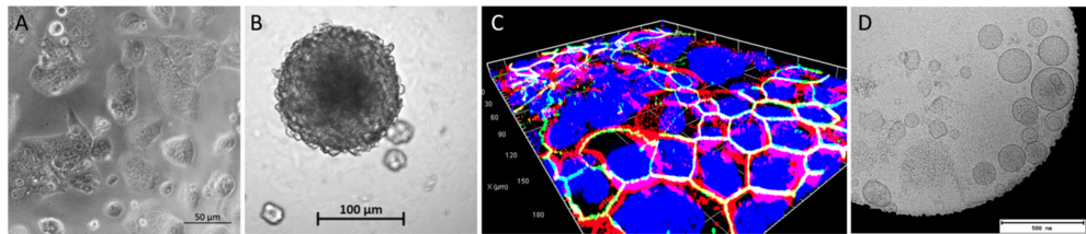 Trophoblast cells can be cultivated in A) monolayers growing on 2D culture, B) 3D spheroids C) or in microfluidic systems also known as placenta barrier on-chip. Here, the green color shows the immunostaining of zona occludens protein 1 and the red color shows β-catenin protein in the trophoblastic cell line BeWo. The nuclei in blue were stained with DAPI (4′,6-diamidino-2-phenylindole).D) Extracellular vesicles secreted by trophoblast cells with size around 100 nm.