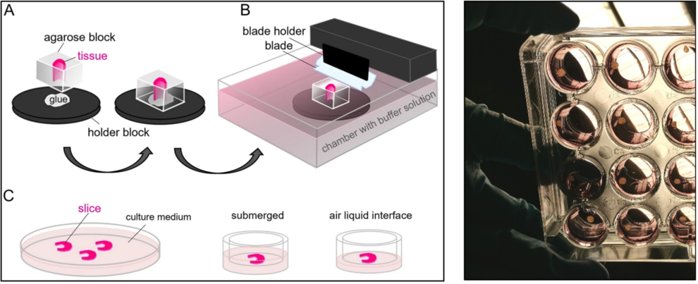 Left: Cutting organ slices with a vibratome [Siwczak, F. et al. Culture of vibrating microtome tissue slices as a 3D model in biomedical research.
J Biol Eng 17, 36 (2023)]. Right: Liver slices in our lab
