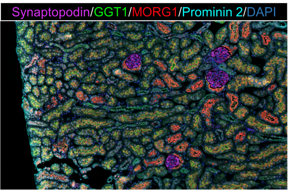 Figure: Representative image of multiplex immunofluorescence to investigate MORG1 expression in different cell types in vivo. Synaptopodin = podocyte marker; GGT1 = proximal tubular cell marker; Prominin 2 = distal tubular cell marker; DAPI = nuclei.
